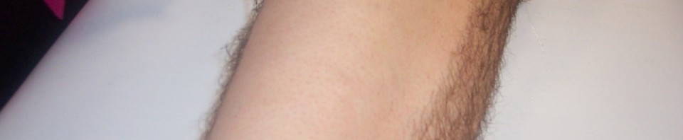 Sponsored Leg wax in aid of Five Sisters Zoo Fire Appeal